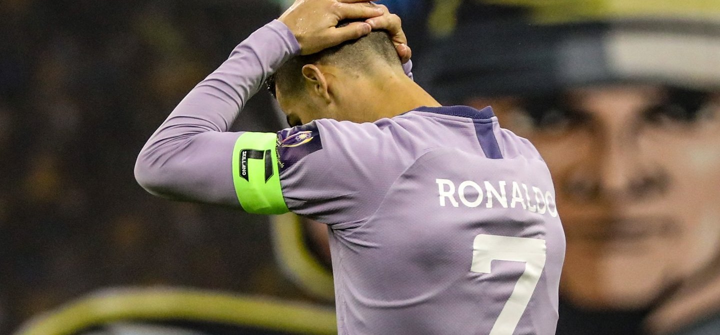 Ronaldo akkora pofont kapott, hogy az álomfizetésével kellett borogatnia