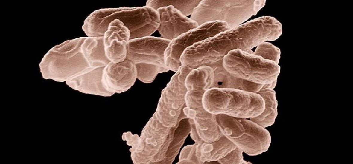 Szegedi kutatók jelentős felfedezést tettek a baktériumok elleni harcban