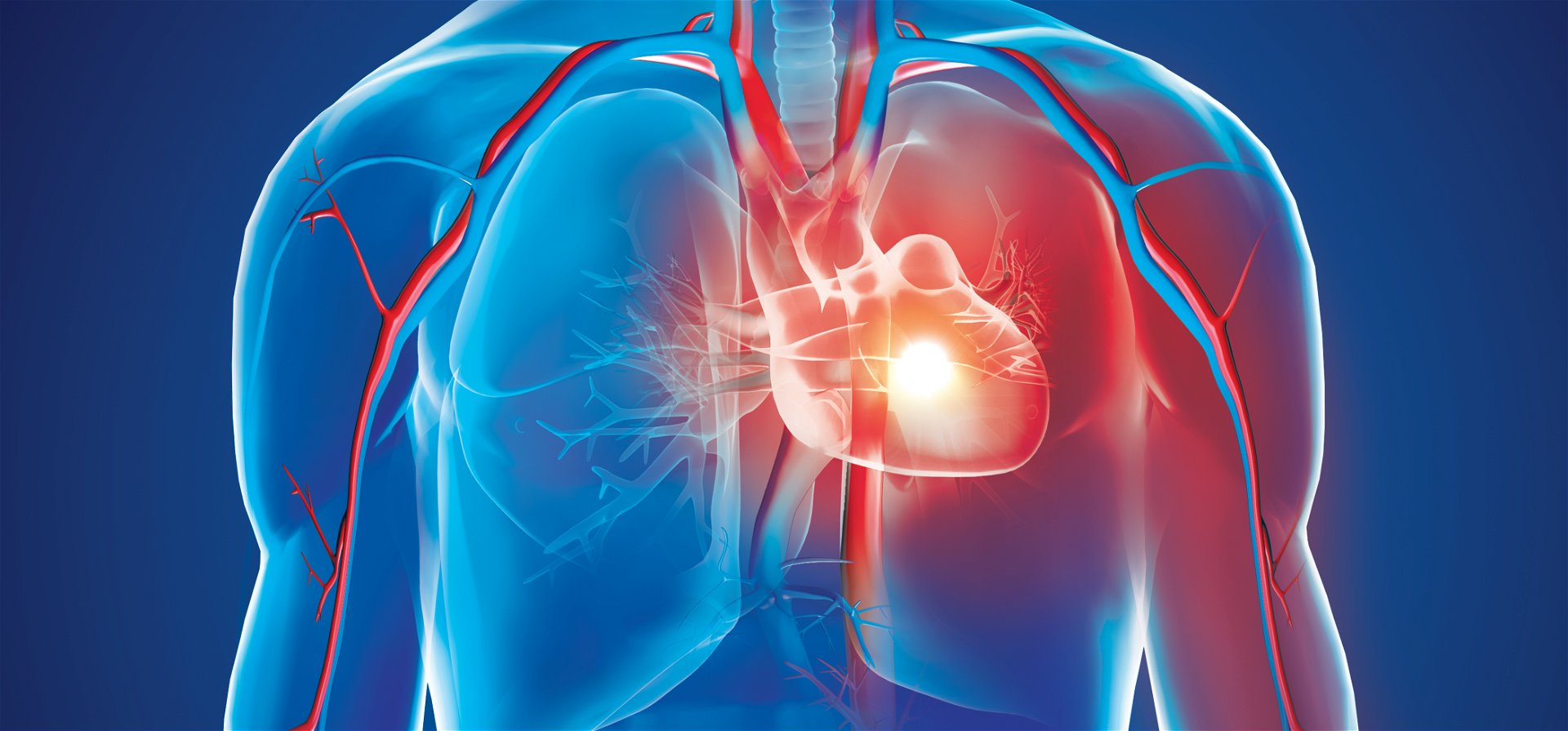 A beteg saját sejtjeiből készült tapasszal gyógyítanák a szívroham okozta károsodást