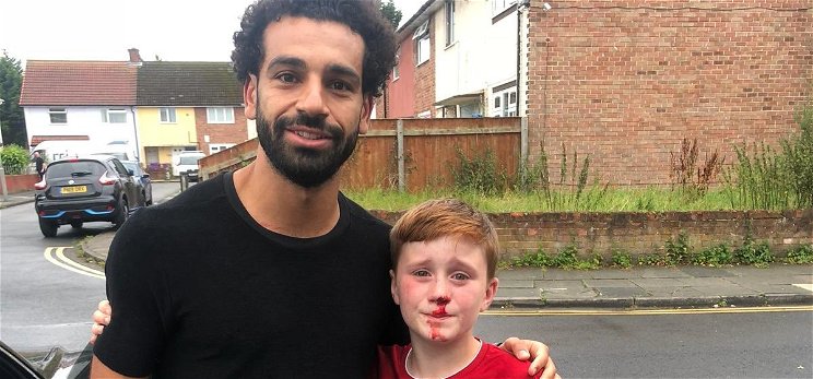 Annyira rohant Salah után egy kisgyerek, hogy lefejelte a villanyoszlopot
