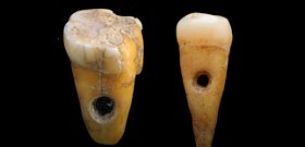 Ékszerként használt, 8500 éves emberi fogakat találtak