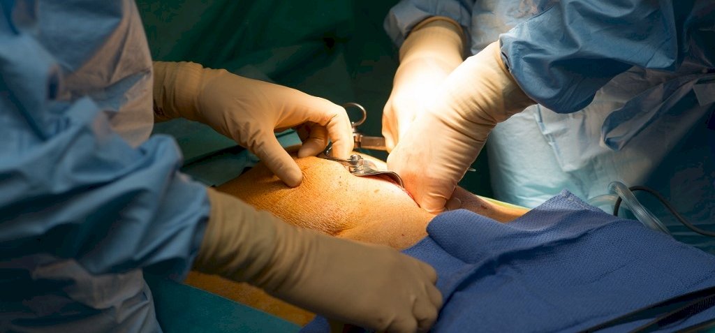 Úttörő műtéti eljárás: fellélegezhetnek a szervátültetésre váró betegek