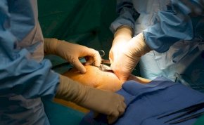 Úttörő műtéti eljárás: fellélegezhetnek a szervátültetésre váró betegek