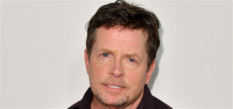 Romlik Michael J. Fox állapota: „A rövid távú memóriámnak lőttek”