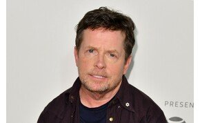 Romlik Michael J. Fox állapota: „A rövid távú memóriámnak lőttek”