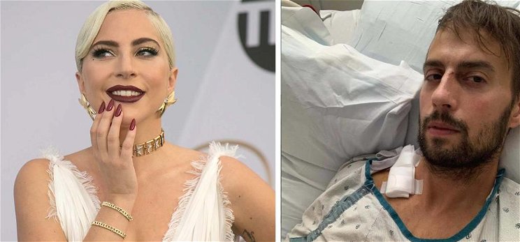 Összeomlott a tüdeje: azonnal meg kellett műteni Lady Gaga kutyasétáltatóját