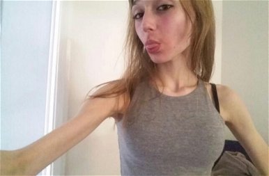 Dögös testépítő lett a 20 éves lány, aki nemrég még anorexiával küzdött – képek