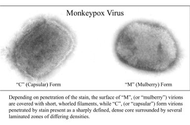 Így néz ki a majomhimlő a testen – megrázó fotókon a betegség
